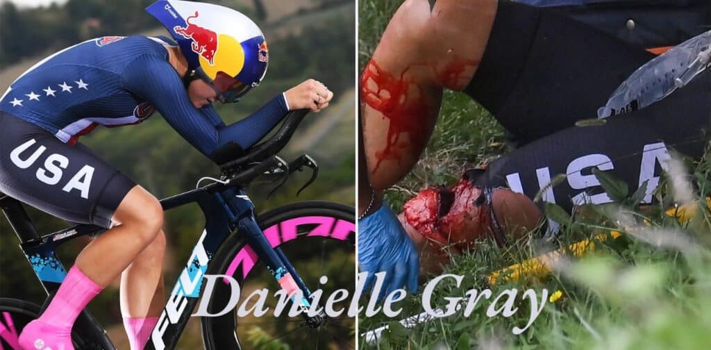 The Details of Danielle Gray’s Motocross Accident